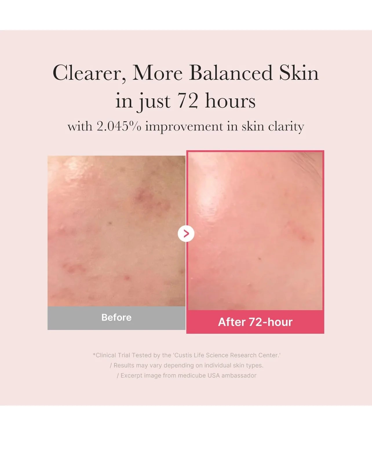 Medicube Txa Niacinamide 15 % Serum